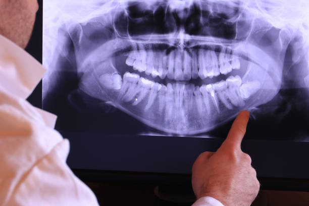 Best Emergency Denture Repair in Hurleyville, NY